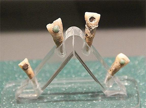 Glue Used by Ancient Maya Dentists to Affix Gems to Teeth Delivers Bonus Benefit - Diamond Designs