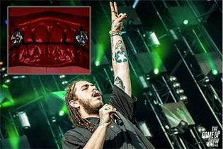  Post Malone Recounts How He Nearly Lost a $600K Diamond Tooth Down a Drain - Diamond Designs